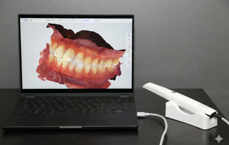 口腔内スキャナー