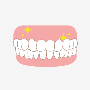 １週間～２週間で白い部分がピンク色の歯肉となります。