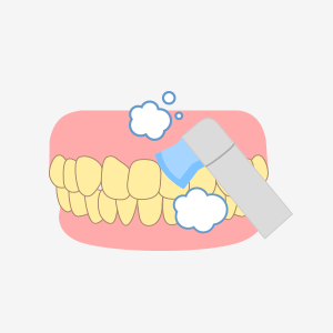歯のクリーニングを行ない自宅での使い方説明