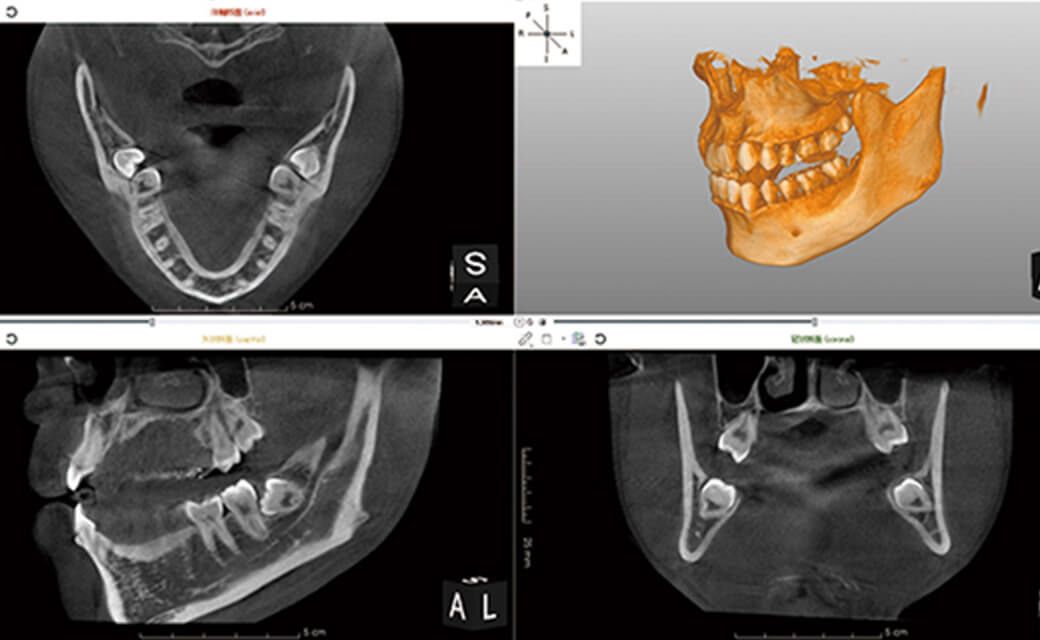 CT撮影と最新のデジタルテクノロジーによる診断