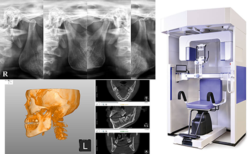 歯科用CT